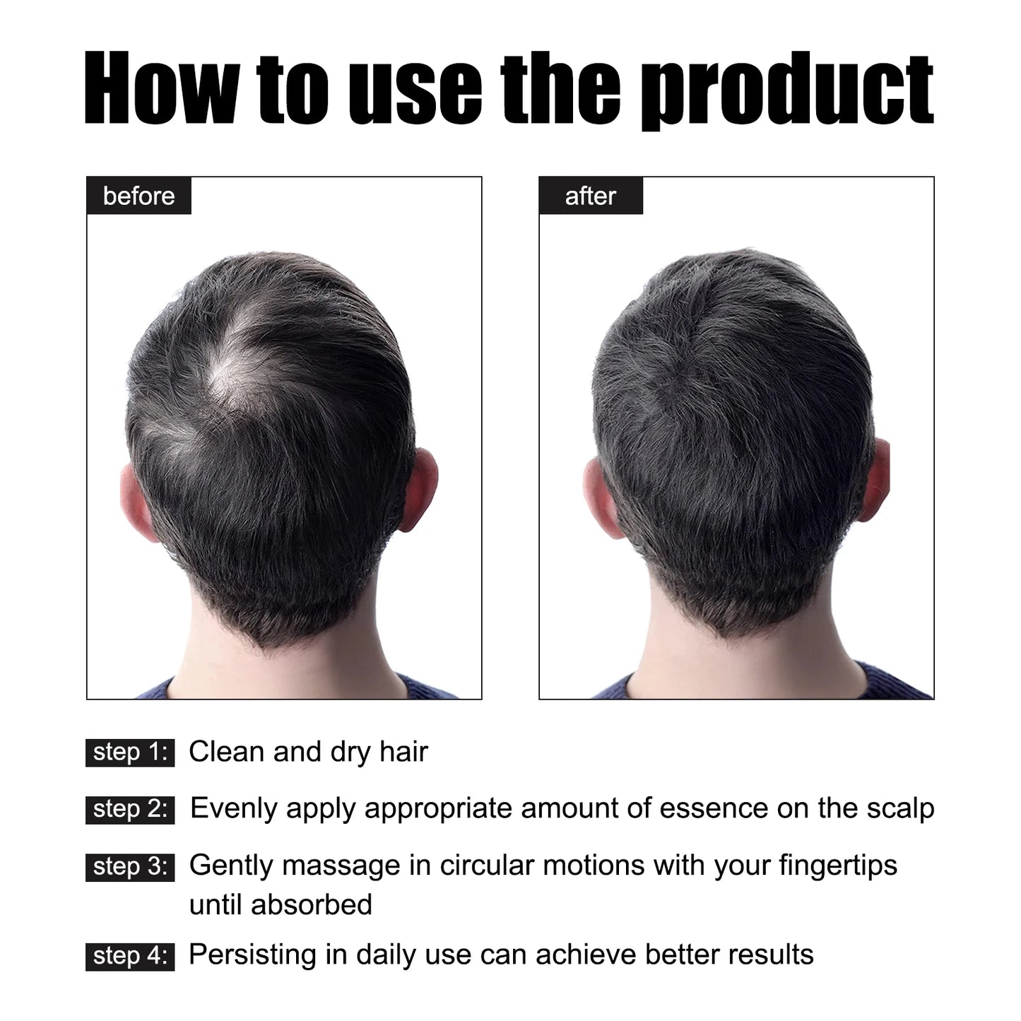 East Moon Men Hair Essence Strengthens Roots And Nourishes Scalp