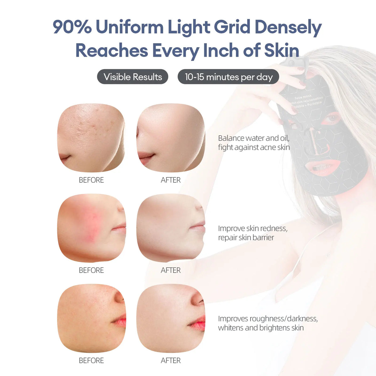 Foreverlily Silicone Led Face Mask For Photon Therapy Skin Repair