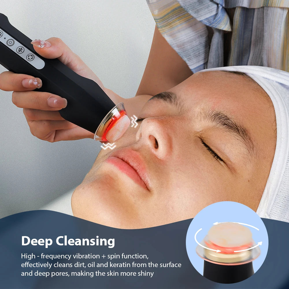 Foreverlily Facial Oxygen Bubble Pen For Skin Rejuvenation And Tightening