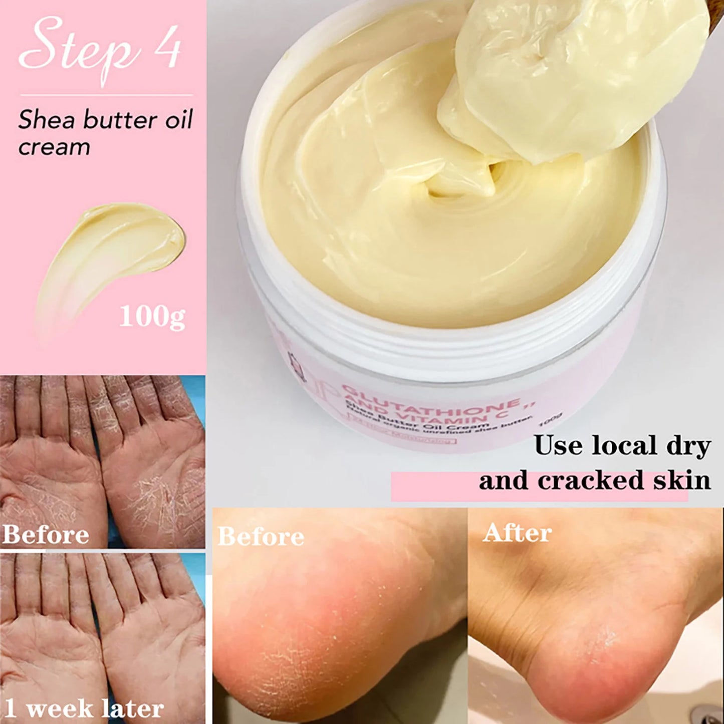 AILKE Whitening Moisturizing Korean Facial And Body Lotion, Reduce Melanin Wrinkles, Vitamin C Dark Spots Remove Skin Care Cream